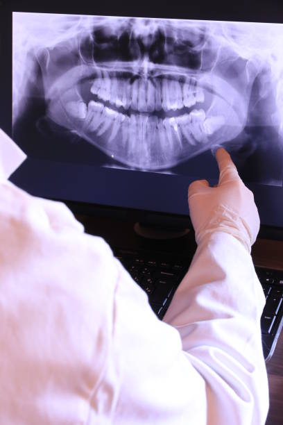 Best Emergency Dentist for Knocked-Out Tooth in Random Lake, WI